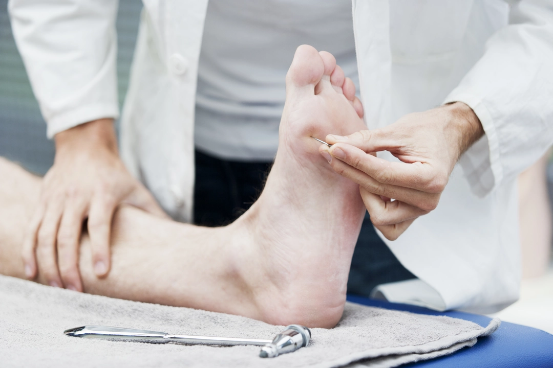 How Acupuncture Can Help Diabetic Peripheral Neuropathy Patients
